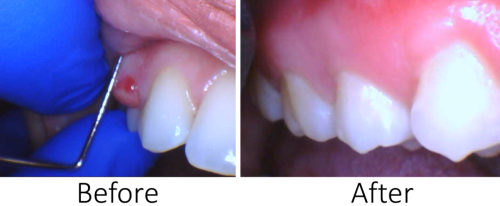 Before-and-After-Silde-2